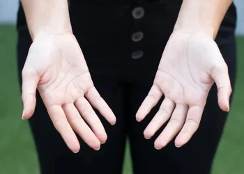 Dolor en las manos: causas frecuentes, síntomas y cuándo consultar al médico
